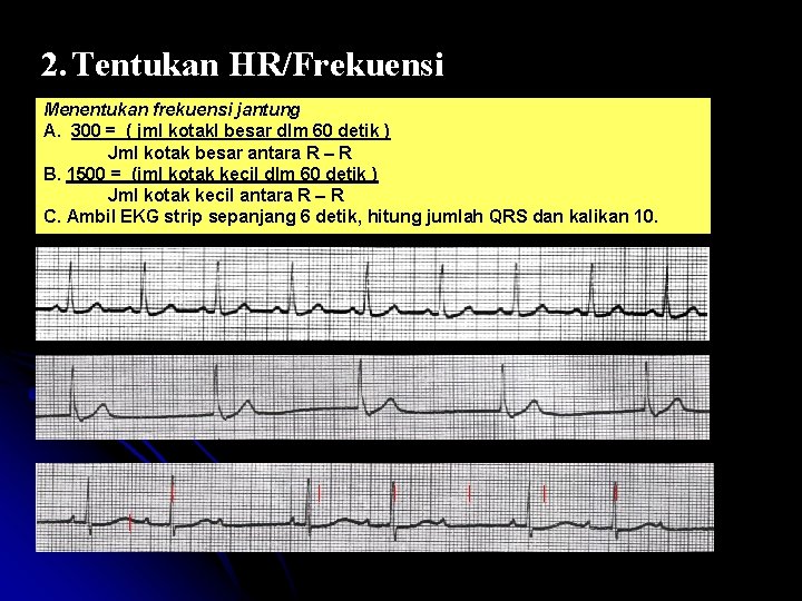 2. Tentukan HR/Frekuensi Menentukan frekuensi jantung A. 300 = ( jml kotakl besar dlm