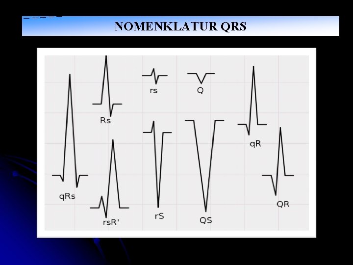 NOMENKLATUR QRS 