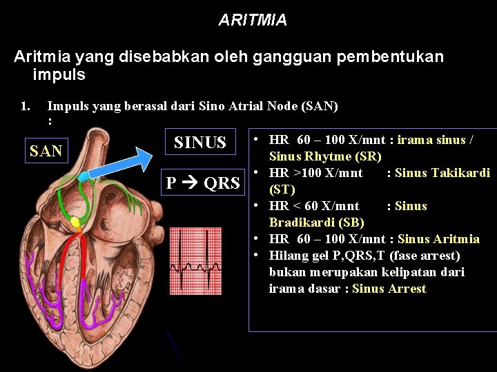 ARITMIA Aritmia yang disebabkan oleh gangguan pembentukan impuls 1. Impuls yang berasal dari Sino