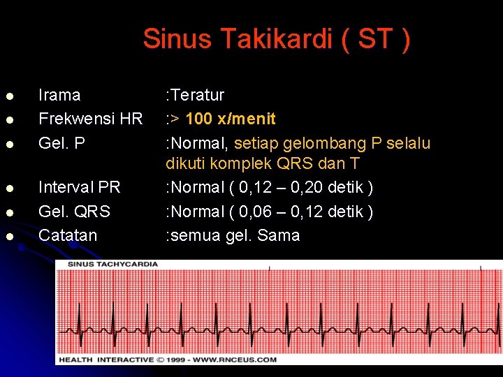 Sinus Takikardi ( ST ) l l l Irama Frekwensi HR Gel. P Interval