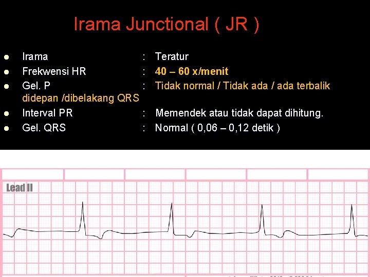 Irama Junctional ( JR ) l l l Irama : Frekwensi HR : Gel.