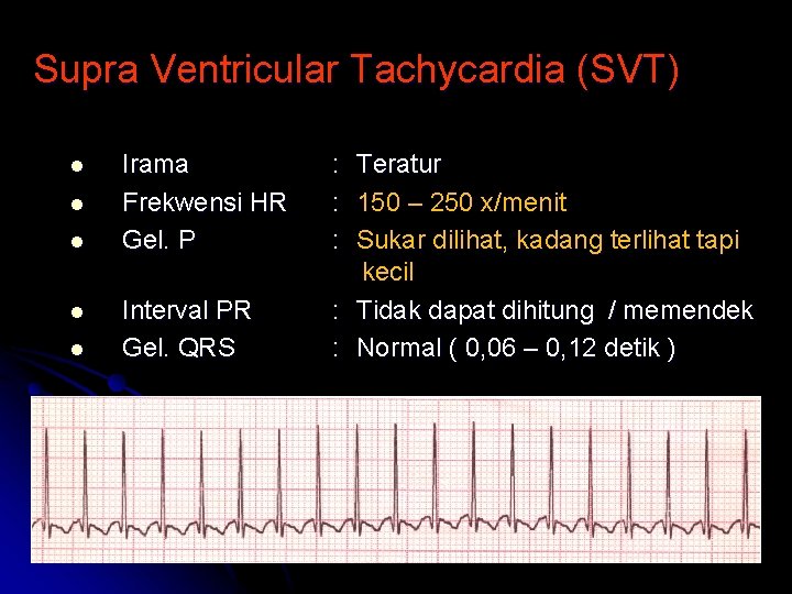 Supra Ventricular Tachycardia (SVT) l l l Irama Frekwensi HR Gel. P Interval PR