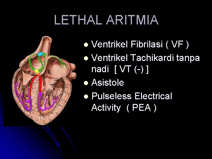 LETHAL ARITMIA Ventrikel Fibrilasi ( VF ) l Ventrikel Tachikardi tanpa nadi [ VT