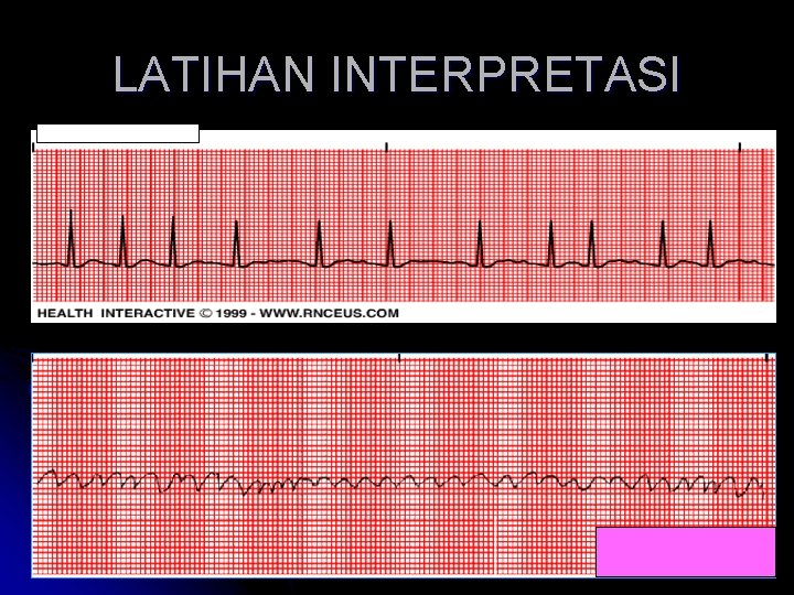 LATIHAN INTERPRETASI 