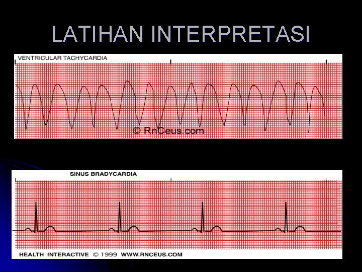 LATIHAN INTERPRETASI 