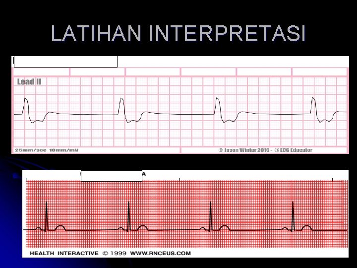 LATIHAN INTERPRETASI 