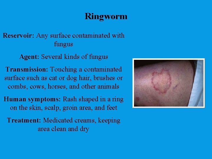 Ringworm Reservoir: Any surface contaminated with fungus Agent: Several kinds of fungus Transmission: Touching