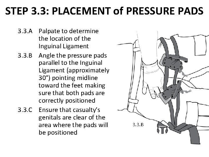 STEP 3. 3: PLACEMENT of PRESSURE PADS 3. 3. A Palpate to determine the