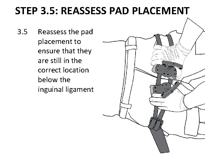 STEP 3. 5: REASSESS PAD PLACEMENT 3. 5 Reassess the pad placement to ensure