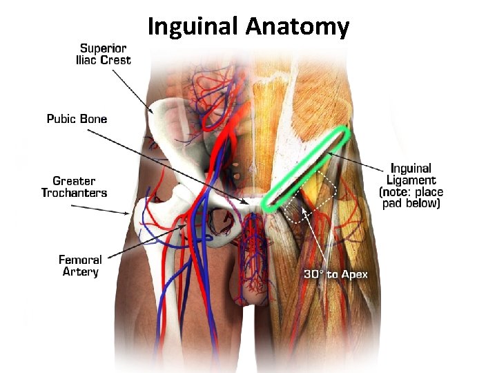 Inguinal Anatomy 