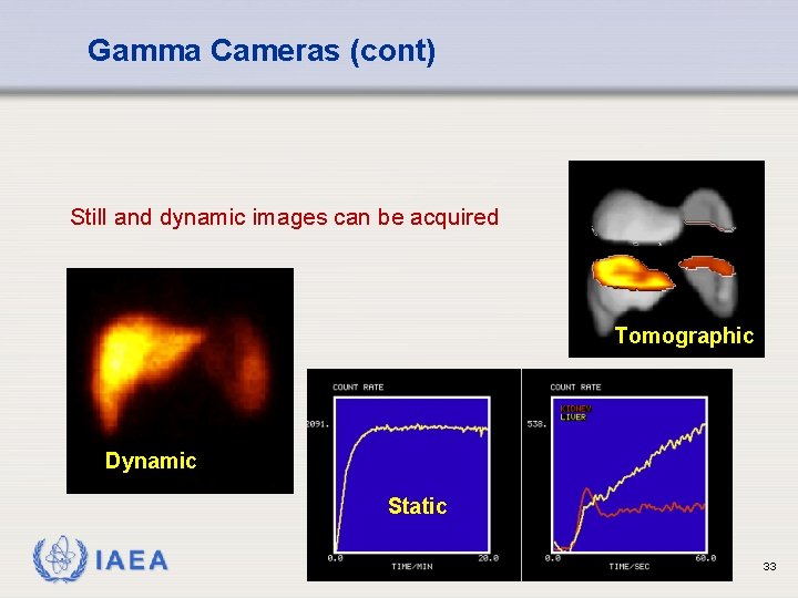 Gamma Cameras (cont) Still and dynamic images can be acquired Tomographic Dynamic Static IAEA
