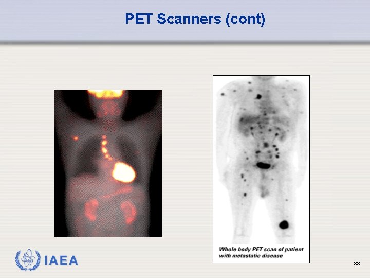 PET Scanners (cont) IAEA 38 