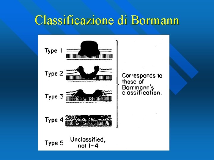 Classificazione di Bormann 