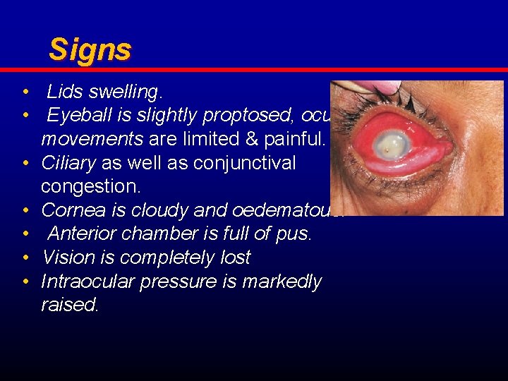 Signs • Lids swelling. • Eyeball is slightly proptosed, ocular movements are limited &