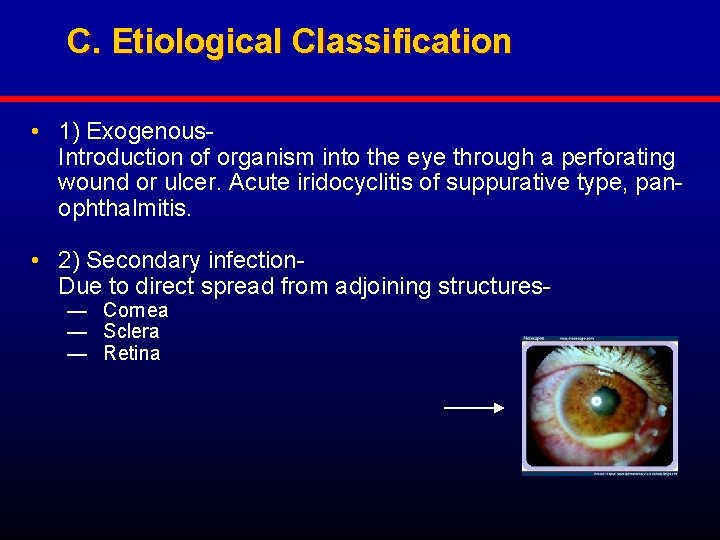 C. Etiological Classification • 1) Exogenous. Introduction of organism into the eye through a