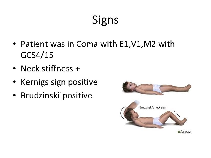 Signs • Patient was in Coma with E 1, V 1, M 2 with