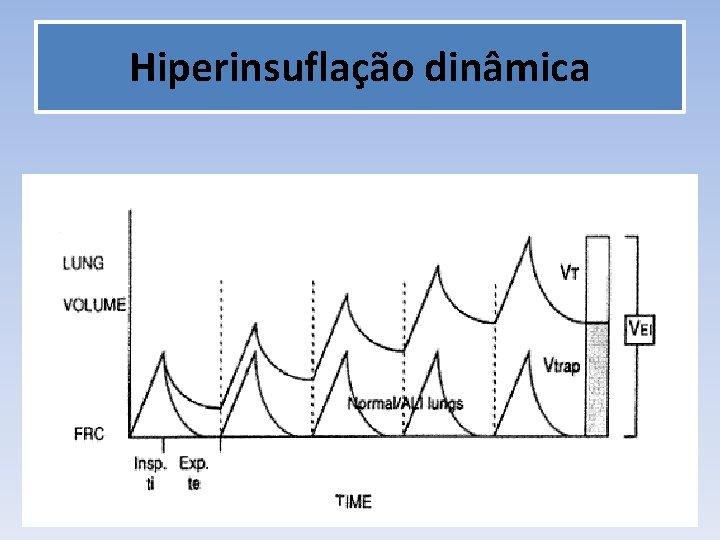 Hiperinsuflação dinâmica 