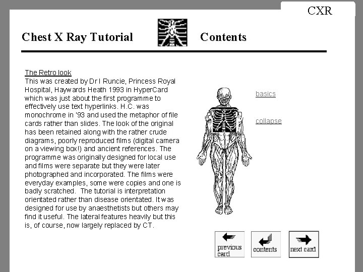 CXR Chest X Ray Tutorial The Retro look This was created by Dr I