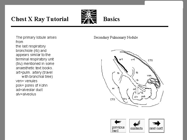 Chest X Ray Tutorial The primary lobule arises from the last respiratory bronchiole (rb)