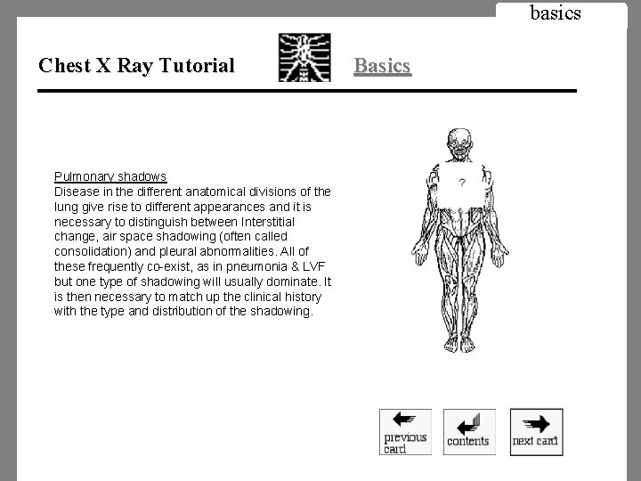 basics Chest X Ray Tutorial Pulmonary shadows Disease in the different anatomical divisions of