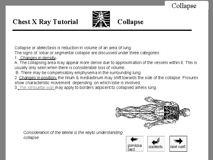 Collapse Chest X Ray Tutorial Collapse or atelectasis is reduction in volume of an