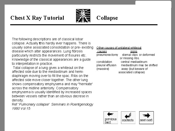 Chest X Ray Tutorial The following descriptions are of classical lobar collapse. Actually this