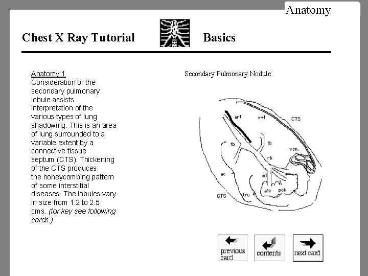 Anatomy Chest X Ray Tutorial Anatomy 1 Consideration of the secondary pulmonary lobule assists