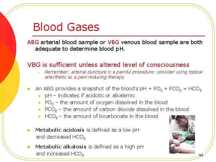 Blood Gases ABG arterial blood sample or VBG venous blood sample are both adequate