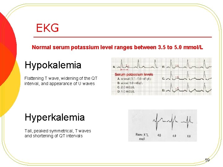 EKG Normal serum potassium level ranges between 3. 5 to 5. 0 mmol/L Hypokalemia