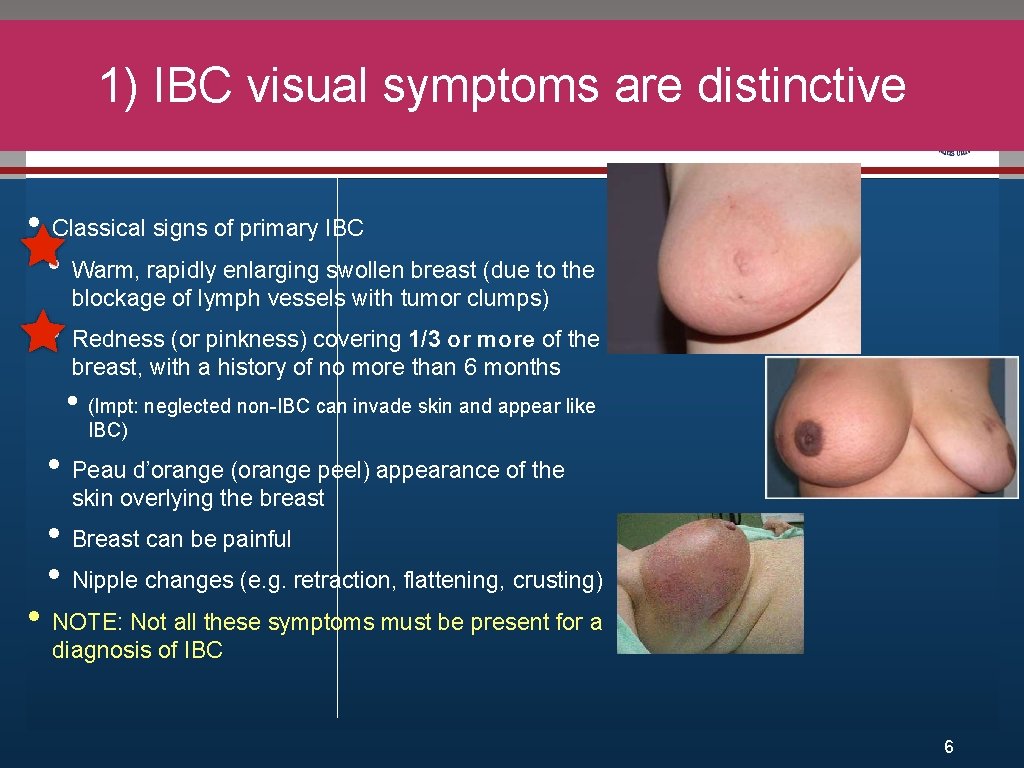 1) IBC visual symptoms are distinctive Click to edit Master title style • Edit