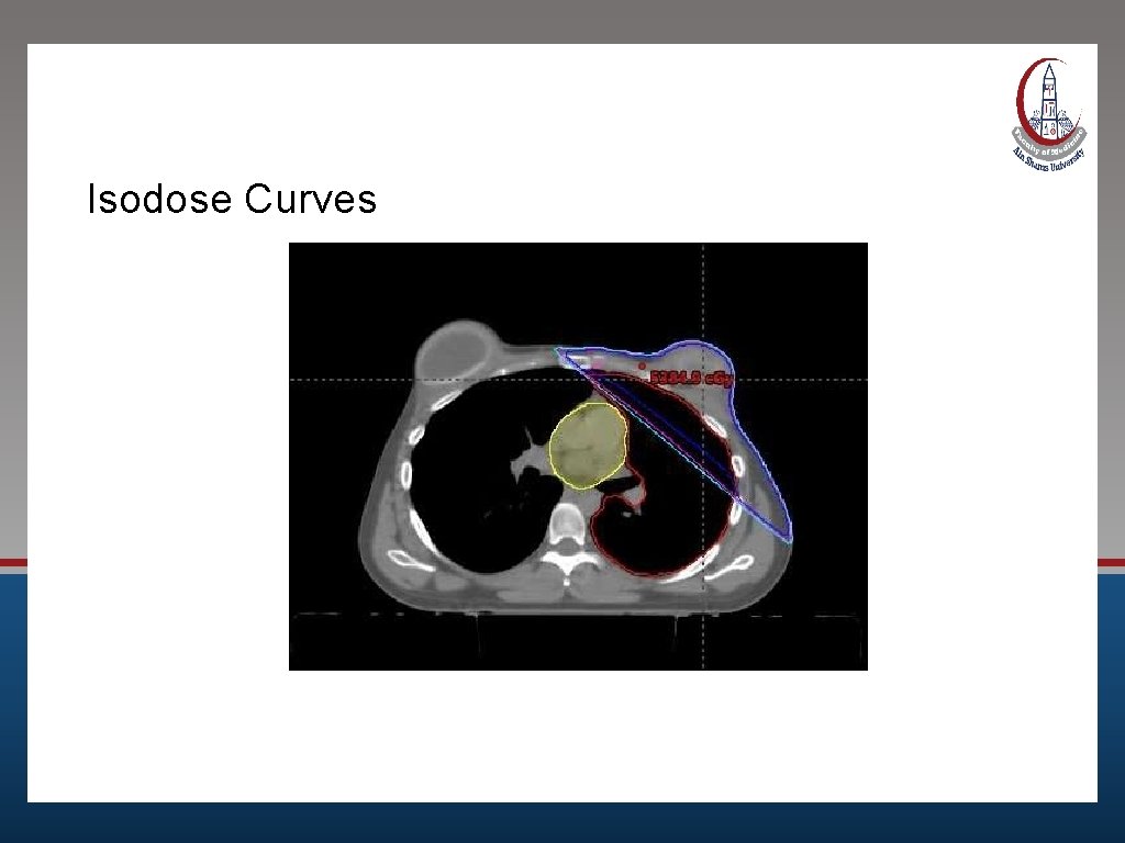 Isodose Curves 