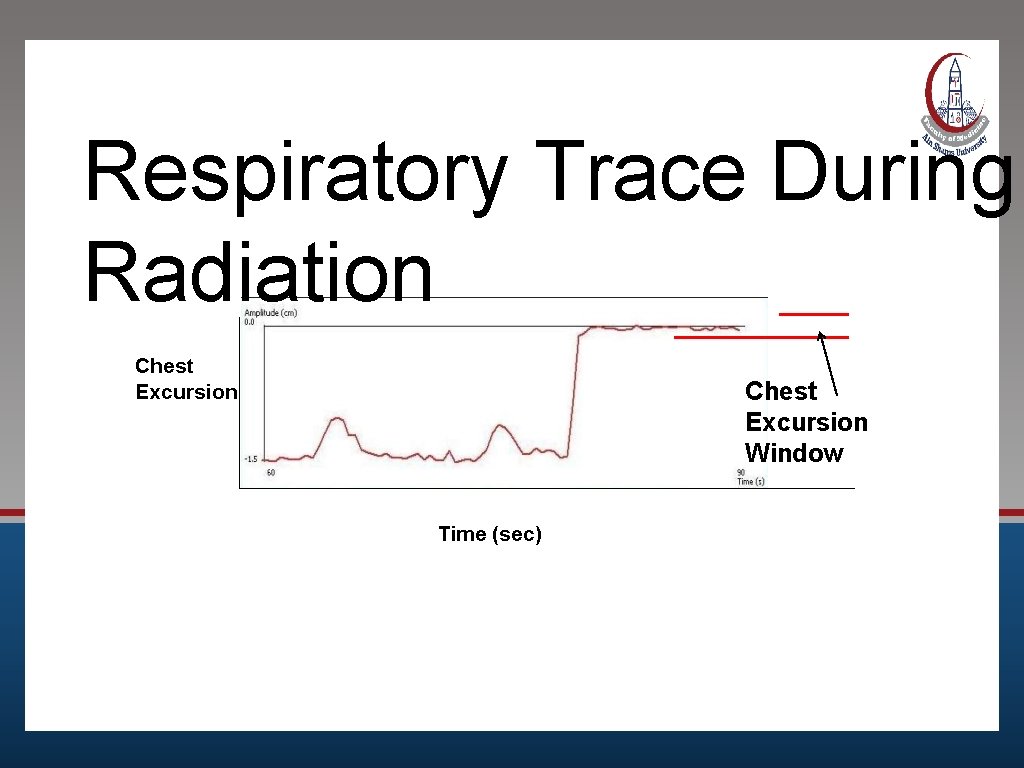 Respiratory Trace During Radiation Chest Excursion Window Time (sec) 