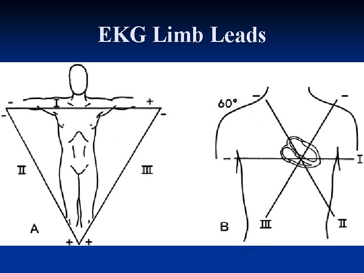 EKG Limb Leads 