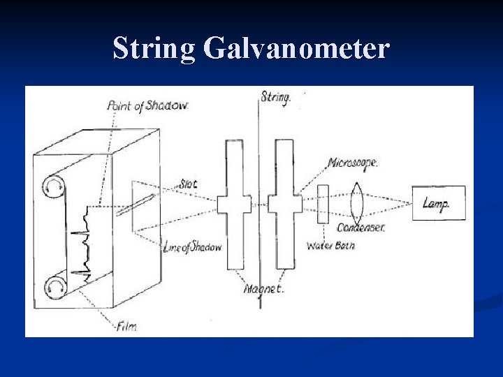 String Galvanometer 