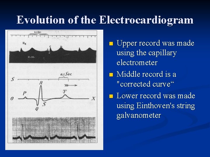 Evolution of the Electrocardiogram n n n Upper record was made using the capillary