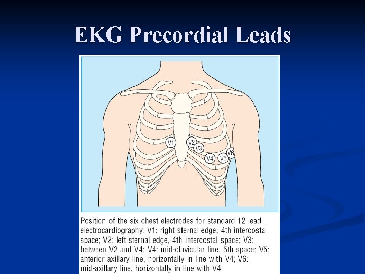 EKG Precordial Leads 
