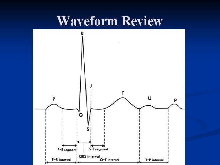 Waveform Review 