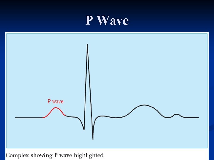 P Wave 