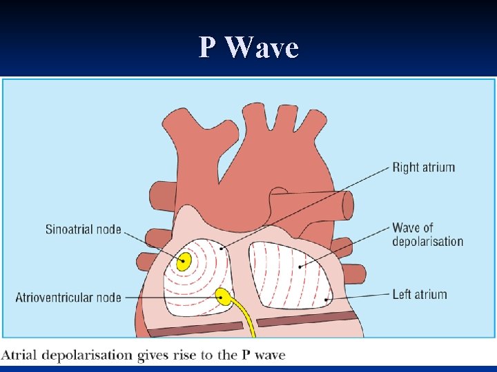 P Wave 