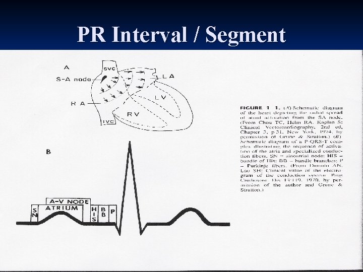 PR Interval / Segment 