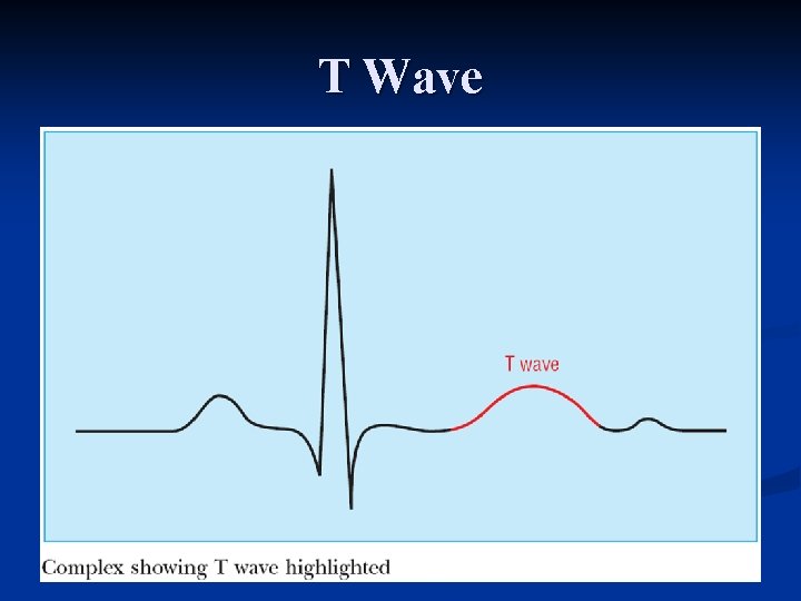 T Wave 