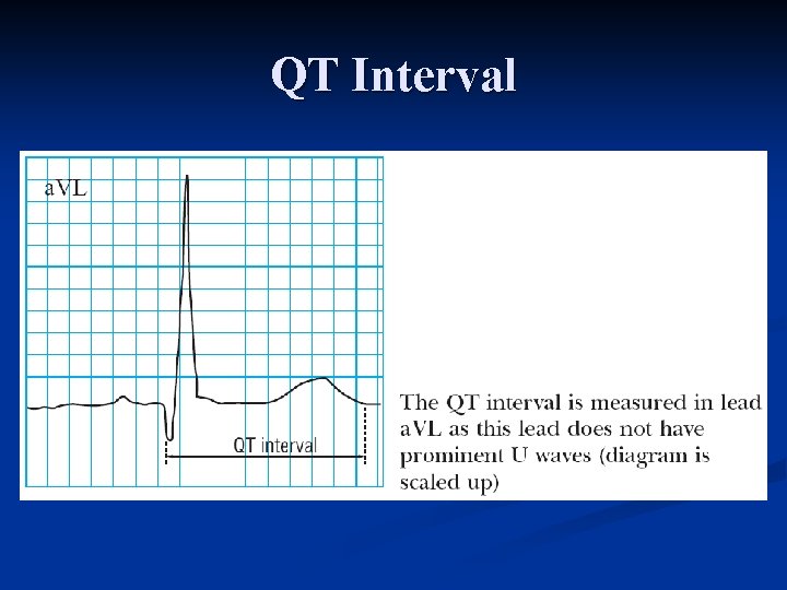 QT Interval 