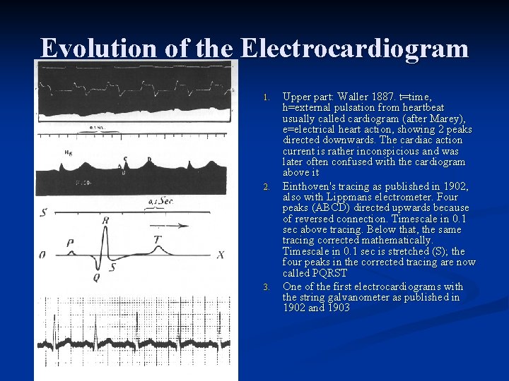 Evolution of the Electrocardiogram 1. 2. 3. Upper part: Waller 1887. t=time, h=external pulsation