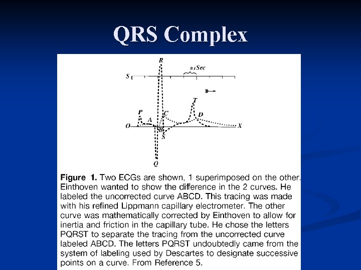 QRS Complex 