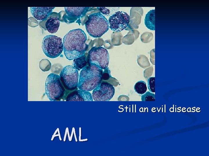Still an evil disease AML 