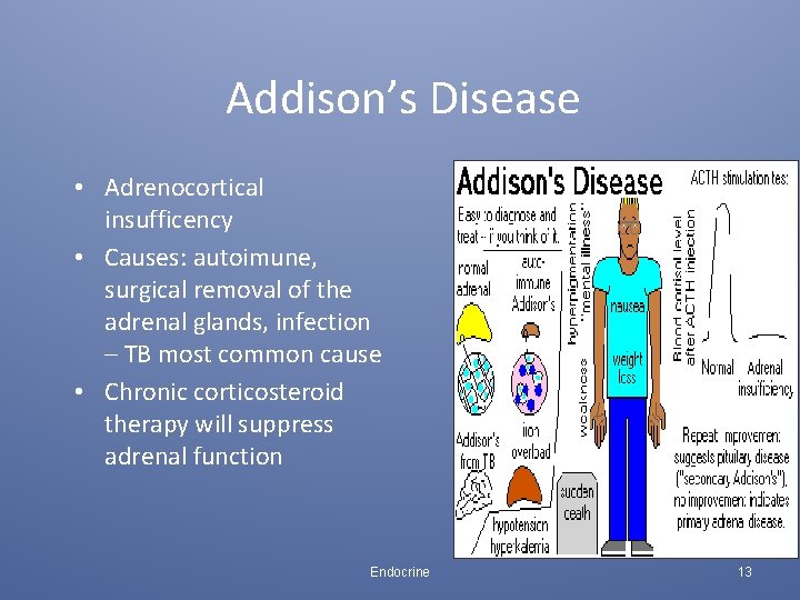 Addison’s Disease • Adrenocortical insufficency • Causes: autoimune, surgical removal of the adrenal glands,