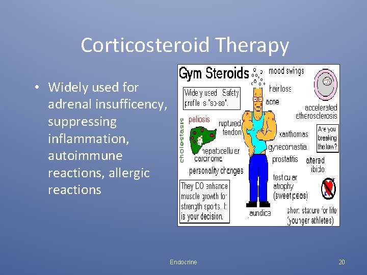 Corticosteroid Therapy • Widely used for adrenal insufficency, suppressing inflammation, autoimmune reactions, allergic reactions