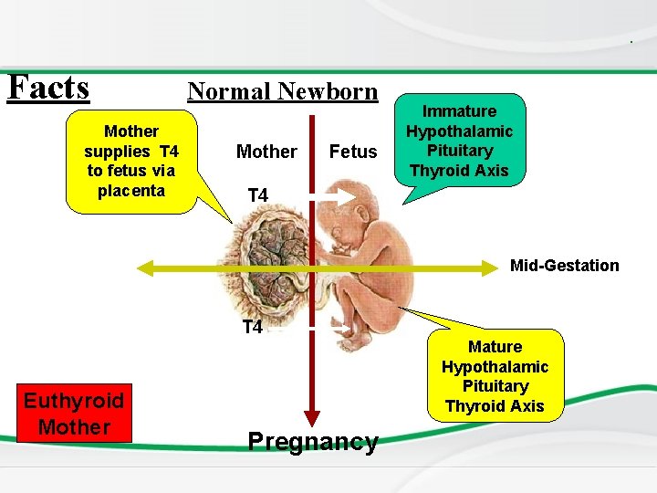 . Facts Mother supplies T 4 to fetus via placenta Normal Newborn Mother Fetus