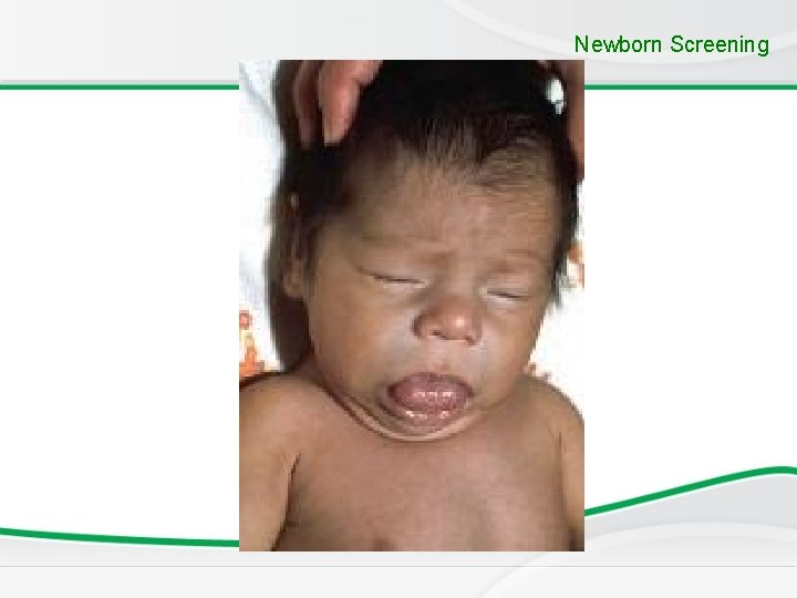 Newborn Screening 