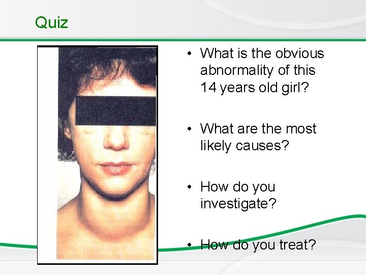 Quiz • What is the obvious abnormality of this 14 years old girl? •